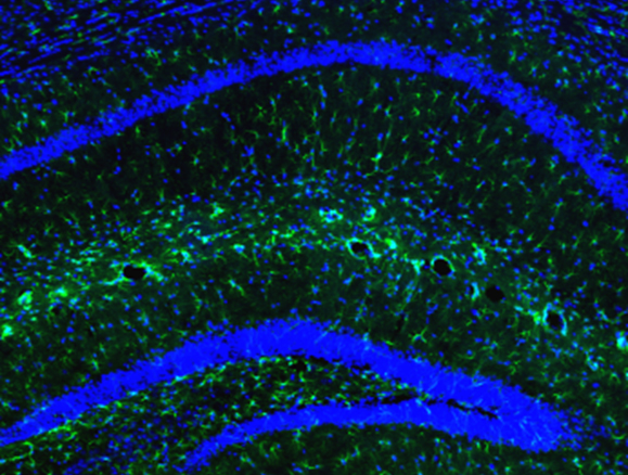 Kang Lab: Tau Pathology via RanBP9 and Hsp90/Hsc70